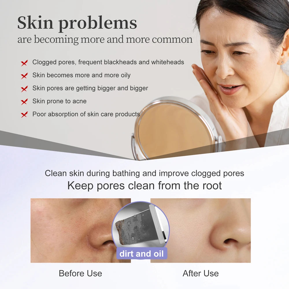 Ultrasonic Skin Scrubber – EMS Lifting & Deep Pore Cleansing
