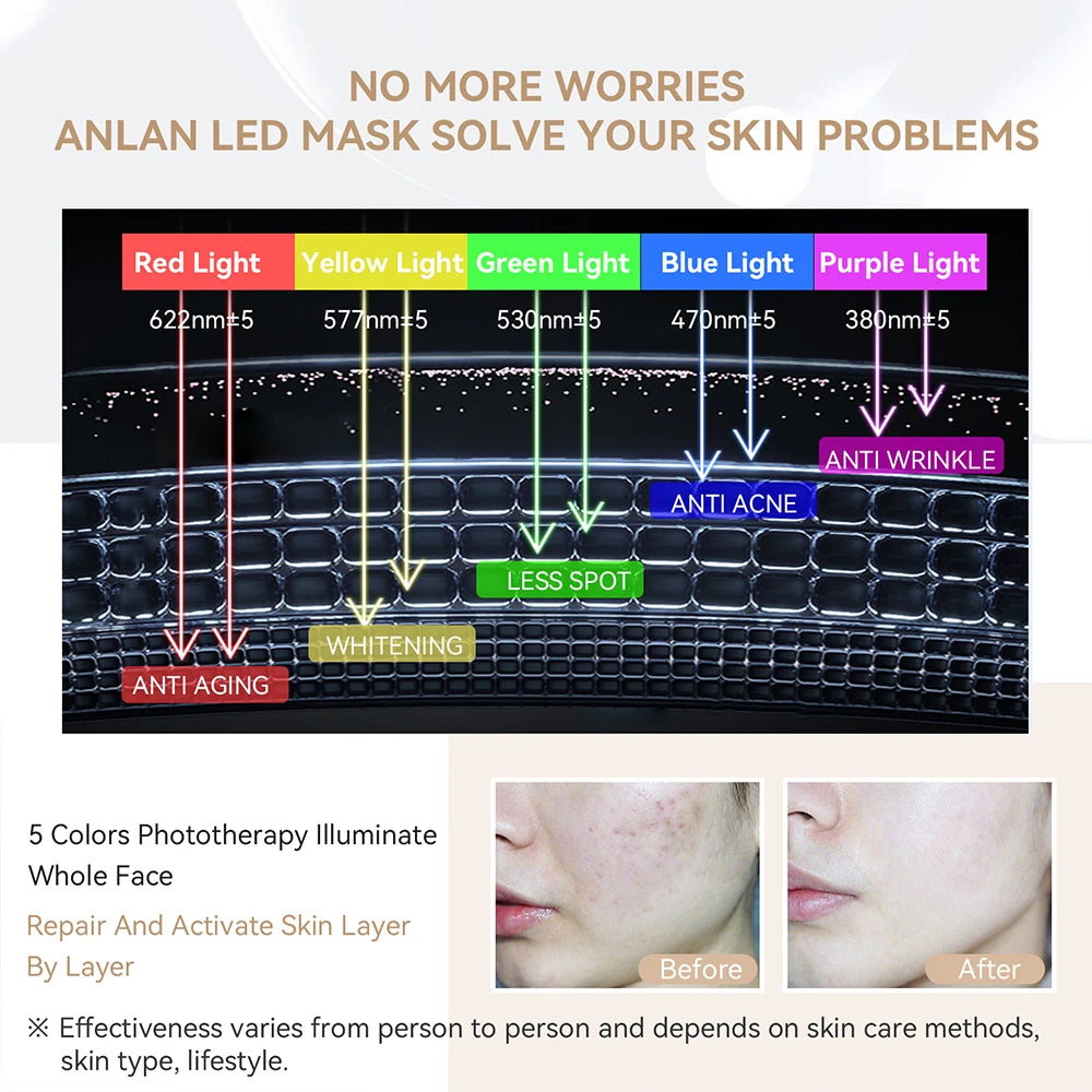 5-Color LED Facial Mask – Anti-Aging, Skin Brightening & Rejuvenation